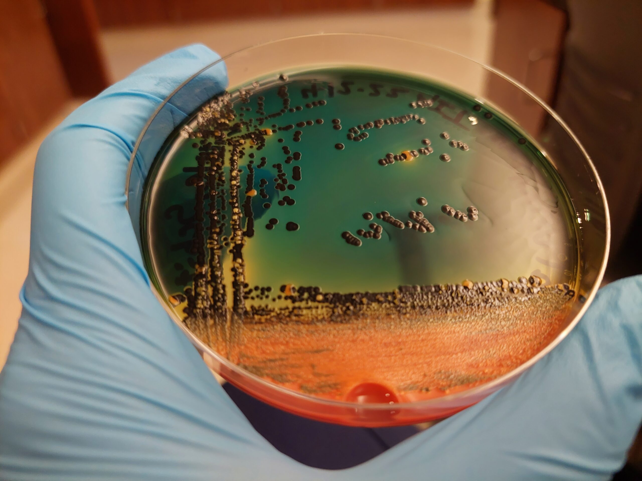 Enteric agar plate after stool culturing for microbiology research. Circular microbial colonies are present on the plate