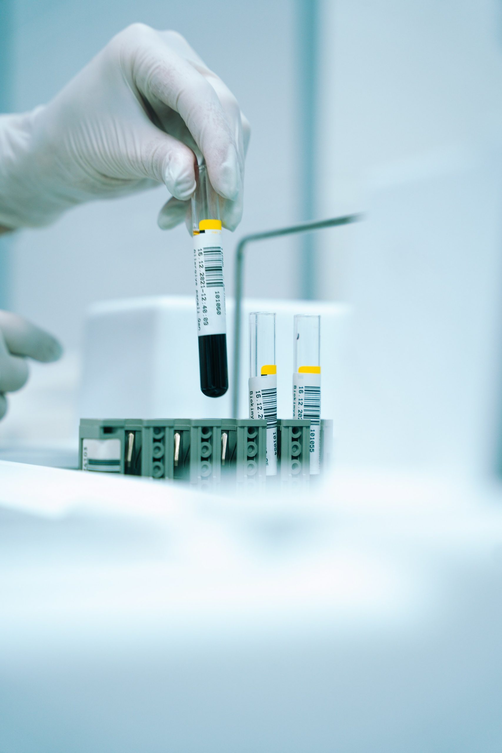 Test tube for sample collection to highlight diagnostics in content marketing