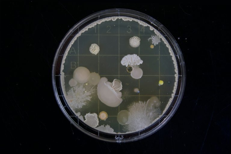 A Petri dish filled with fungal and bacterial colonies.